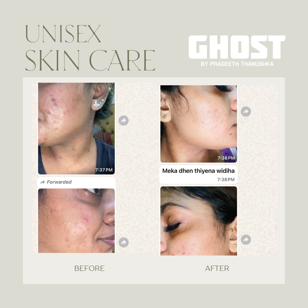 Home ghost skincare 20