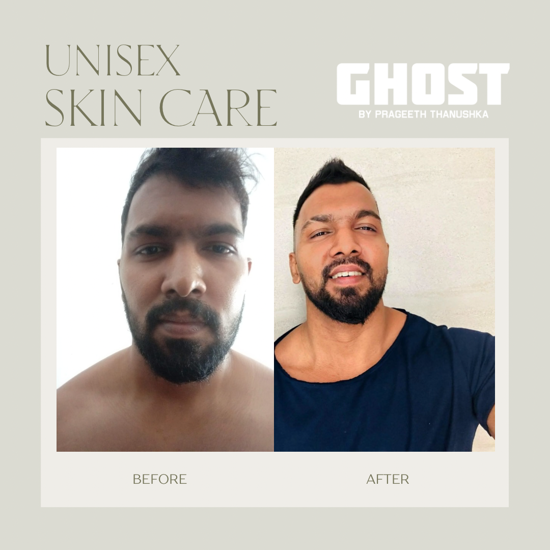 Home green gentle before and after instagram post 1