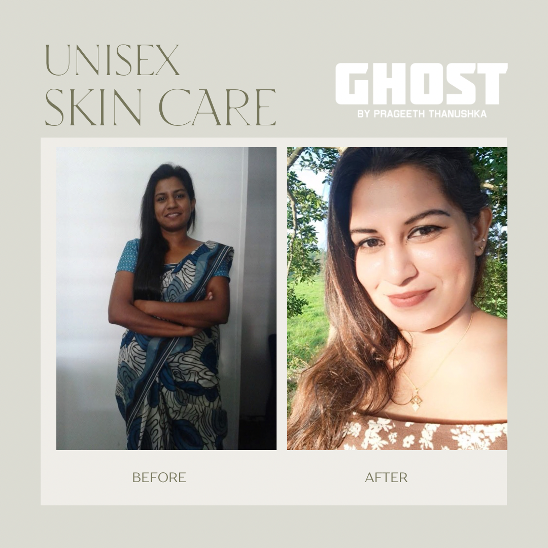 Home green gentle before and after instagram post 3